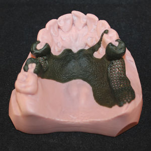 Harz für 3D-Drucker / Polymer / für Dentalaufnahmen