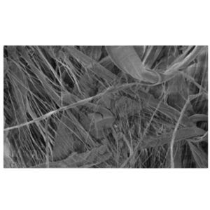 Gewebe-Filtermedium 1