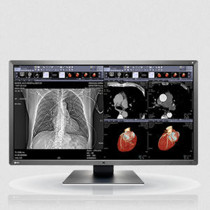 LCD-Monitor 1