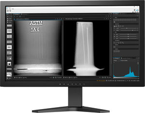 Röntgenbilder-Visualisierung-Software