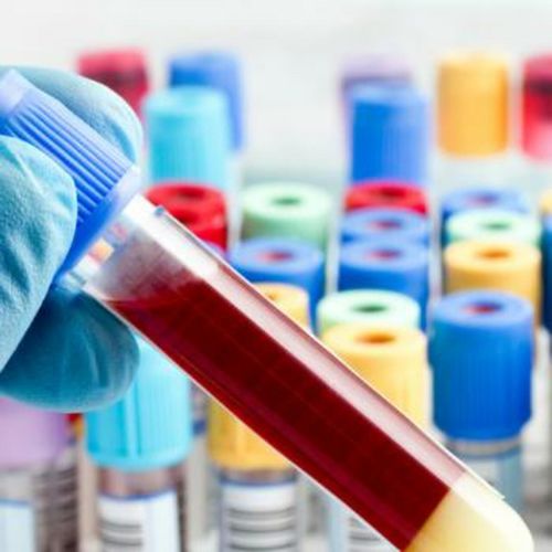 Additiv für die Pharmaindustrie - Celpure® - Imerys Ceramics  - Kieselgur / mit hoher Reinheit