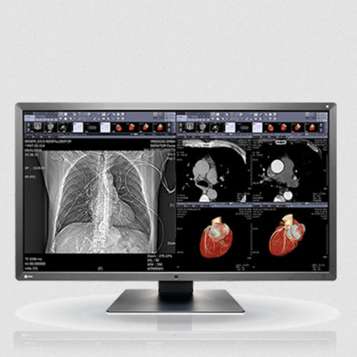 LCD-Monitor - MX315W - EIZO NANAO - mit LED-Rückbeleuchtung / für die Medizintechnik / 31,5"