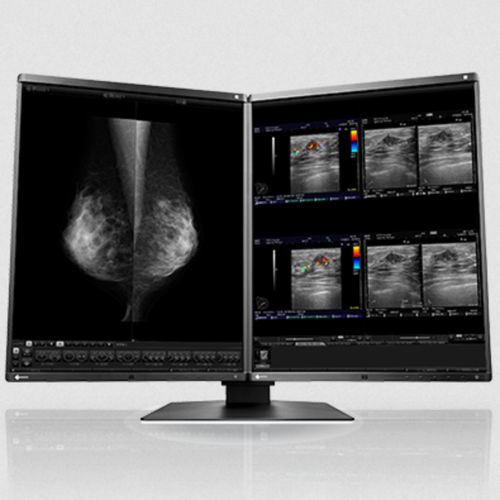 LCD-Monitor - RX560 series - EIZO NANAO - mit LED-Rückbeleuchtung / für die Medizintechnik / 21.3"