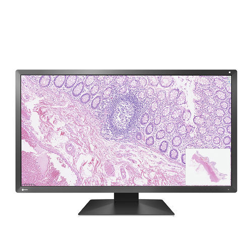 LCD-Monitor - PX3150 - EIZO NANAO - mit LED-Rückbeleuchtung / für Anzeige / für die Medizintechnik