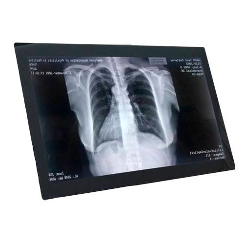 Monitor für die Medizintechnik - HSINTEK Electronics Co., Ltd - LCD / mit LED-Rückbeleuchtung / für Hygieneanwendungen