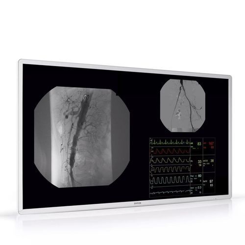 IPS-Display - MDAC‑8355 - Barco - hochauflösend / UHD / 55"
