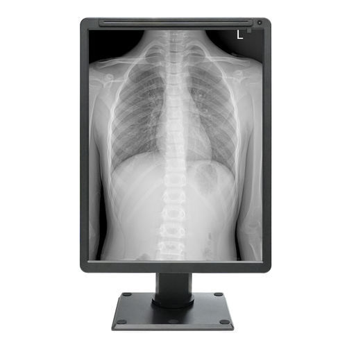 Medizinische Anzeigetafel - MDC-G2201 - ZRT Technology - monochrom / 21.3" / HDMI