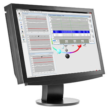 Überwachungssoftwarelösung - ESWin QC - X-Rite Pantone - Steuerung / Reporting / Produktionssteuerung