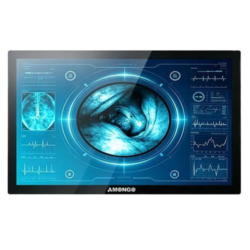 Monitor mit Touchscreen - AMG-32OPGER1G2 - AMONGO Display Technology(ShenZhen)Co.,LTD - mit LED-Rückbeleuchtung / für die Medizintechnik / 32"