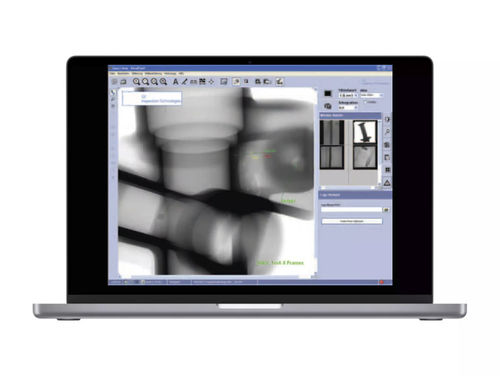 Analysesoftware - VISTAPLUS V - Waygate Technologies - Röntgenbilder-Visualisierung / Bilderfassung / Datenarchivierung