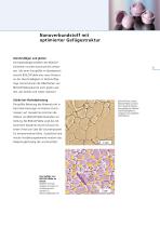 BIOLOX®delta - The Fourth Generation of Ceramics-9